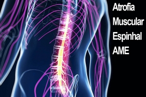 Atrofia Muscular Espinhal é discutida em audiência pública na AL